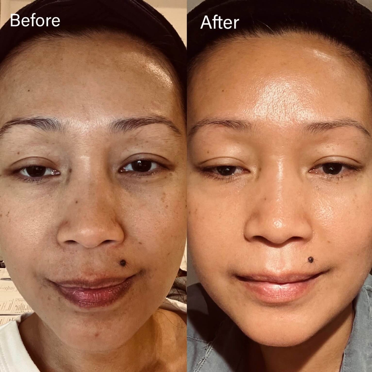 photo of a woman before and after using skincare
